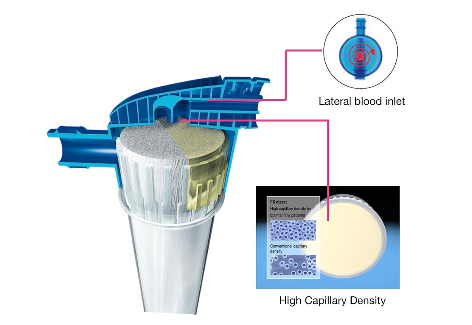 Avantages de la conception des dialyseurs FX-class®