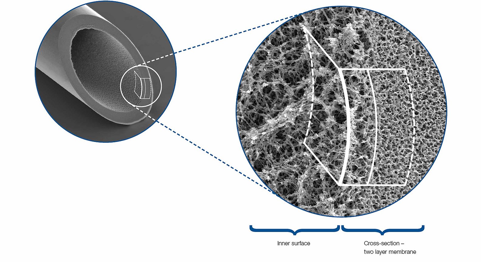 Elektronenmikroskopbild von Plasmafiltern