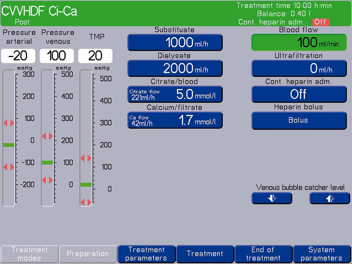 Standardeinstellungen der multiFiltrate Ci-Ca® postCVVHDF
